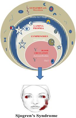 Current Insights in Microbiome Shifts in Sjogren’s Syndrome and Possible Therapeutic Interventions